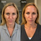 Retinal Shot plus - Retrouvez la peau de vos 20 ans