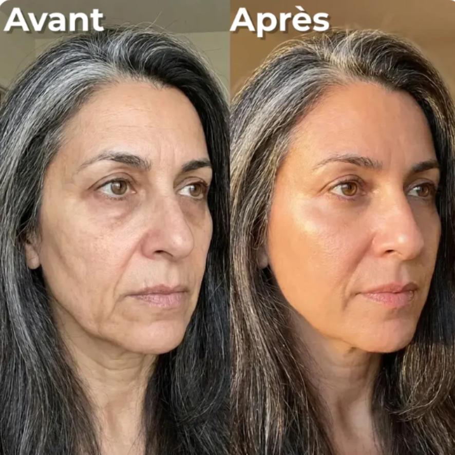 Retinal Shot plus - Retrouvez la peau de vos 20 ans