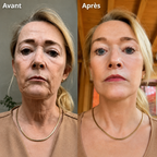 Retinal Shot plus - Retrouvez la peau de vos 20 ans